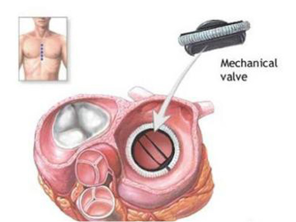 مؤشر درجة الحرارة والوقت لمراق