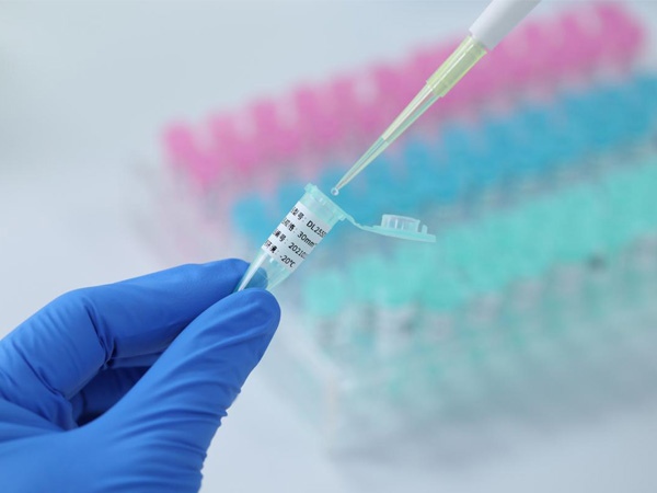 مسجل درجة حرارة بتقنية البلوتو